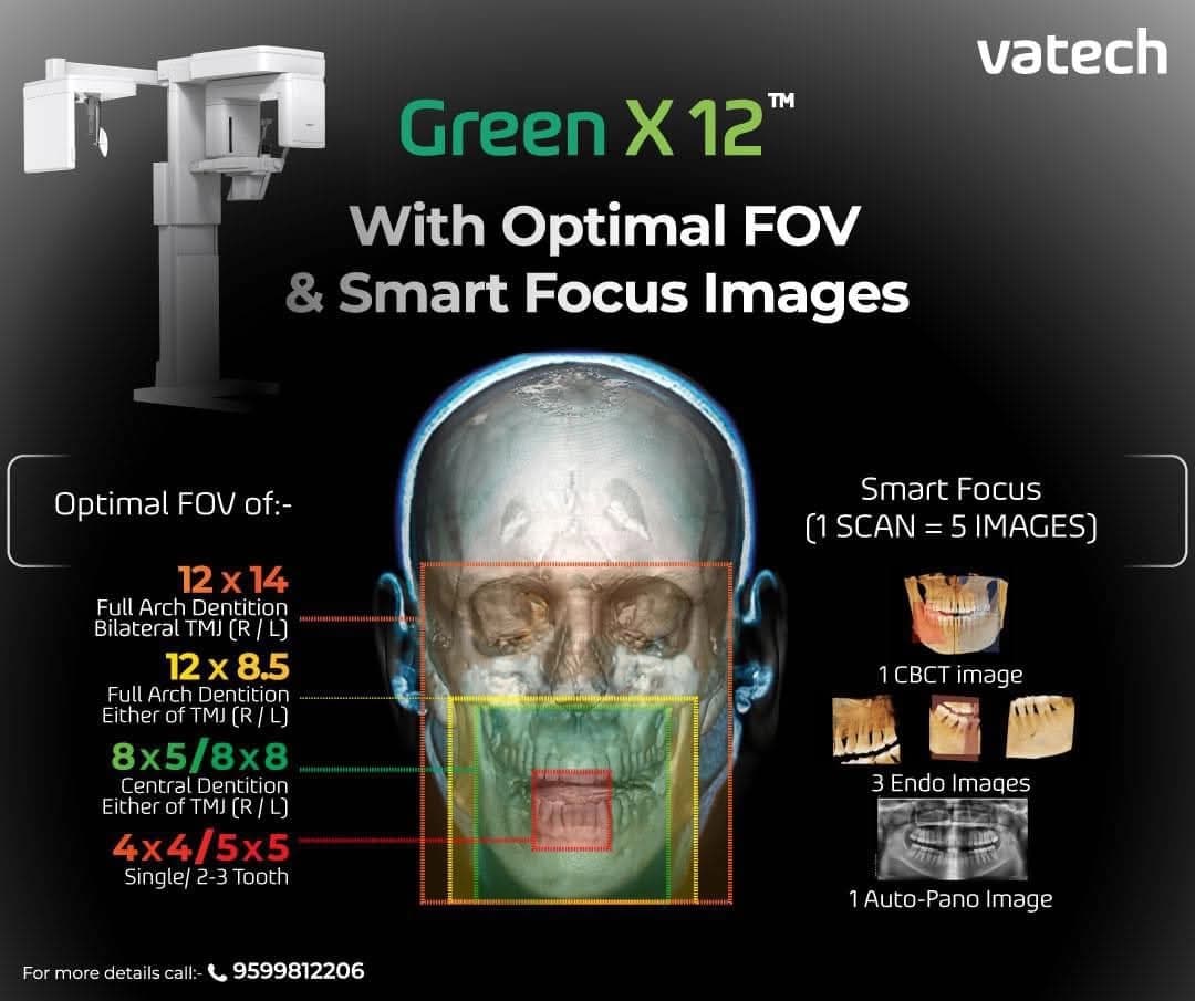Al-Barraq Scan for X-ray Imaging